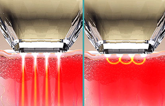 DIAMOND TIP image