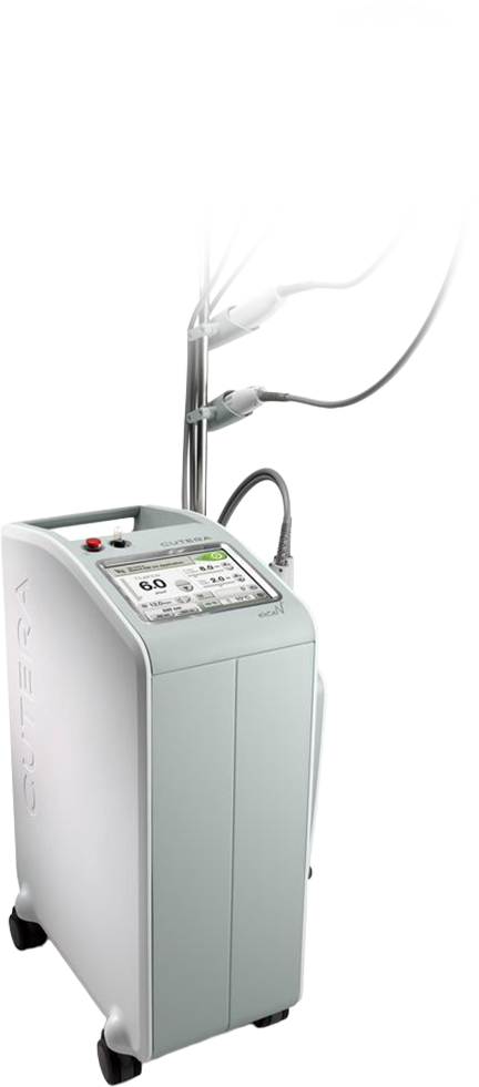 Excel V laser device for improving melasma, redness, pigmentation, and skin elasticity