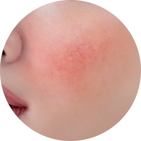Skin tone improvement image