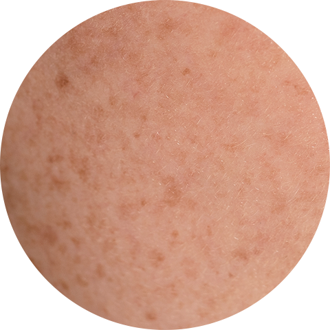 Blemishes image