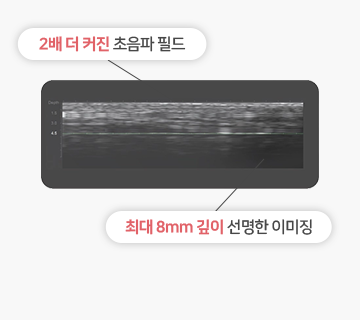 Key point image