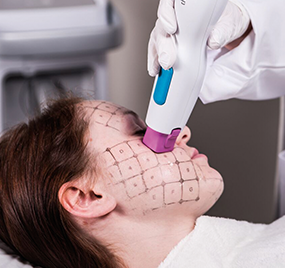 AccuREP™ technology image