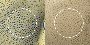 Comparison of pore size before and after Elravie Re2O treatment