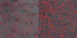 Comparison of skin texture density before and after Elravie Re2O treatment