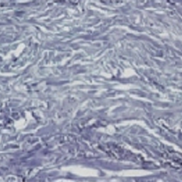 Elastin tissue 6 months after treatment