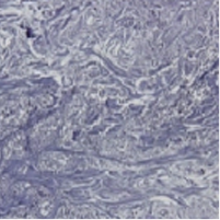 Elastin tissue 3 months after treatment