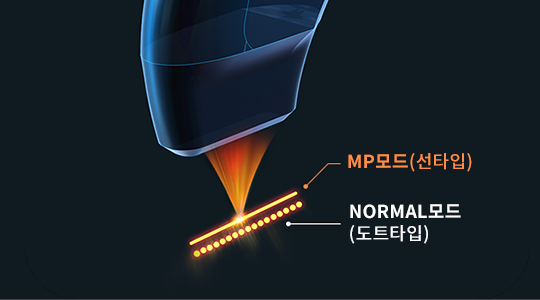ULTRA F Handpiece Image